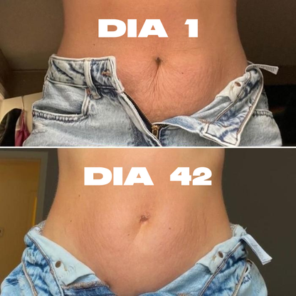 LUVARE™ – Crema Reafirmante Anti-Estrías