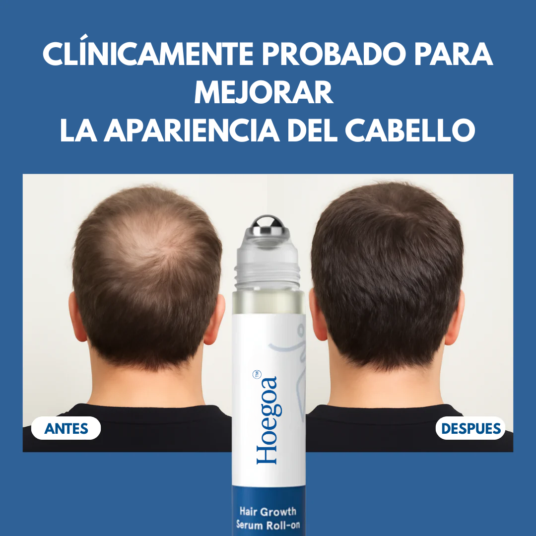 Hoegoa™ Roll-On Anti-Caída y Crecimiento Capilar