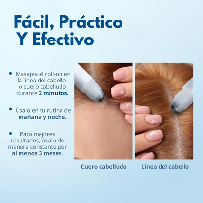 Hoegoa™ Roll-On Anti-Caída y Crecimiento Capilar
